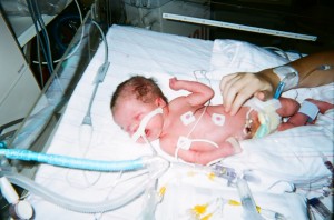 Mandy at 2 days old